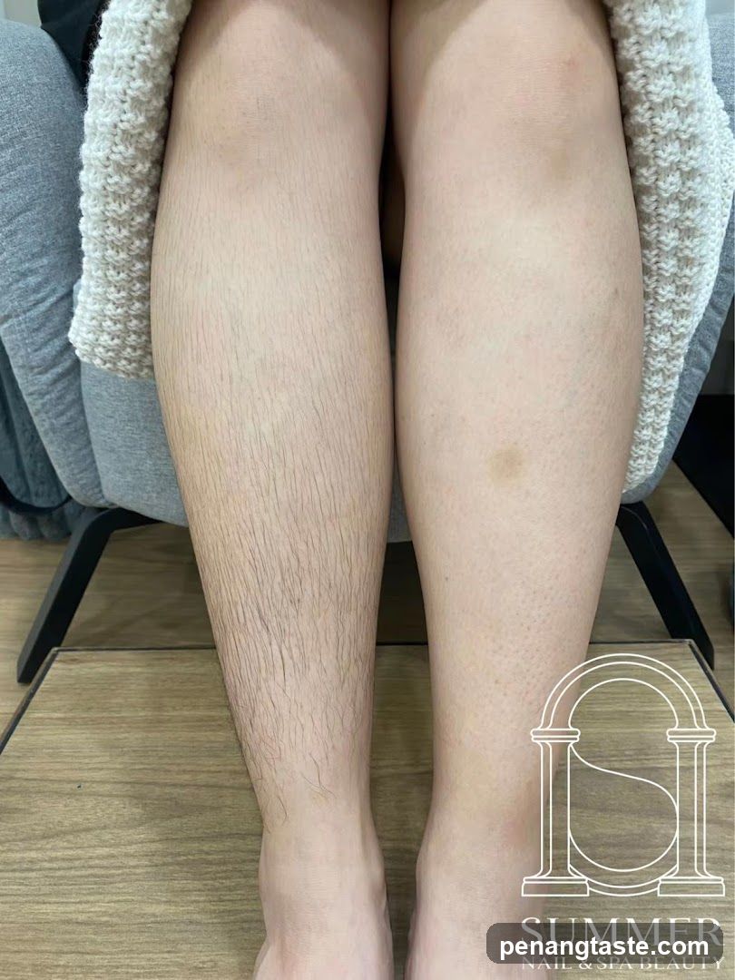 Legs before and after hair removal