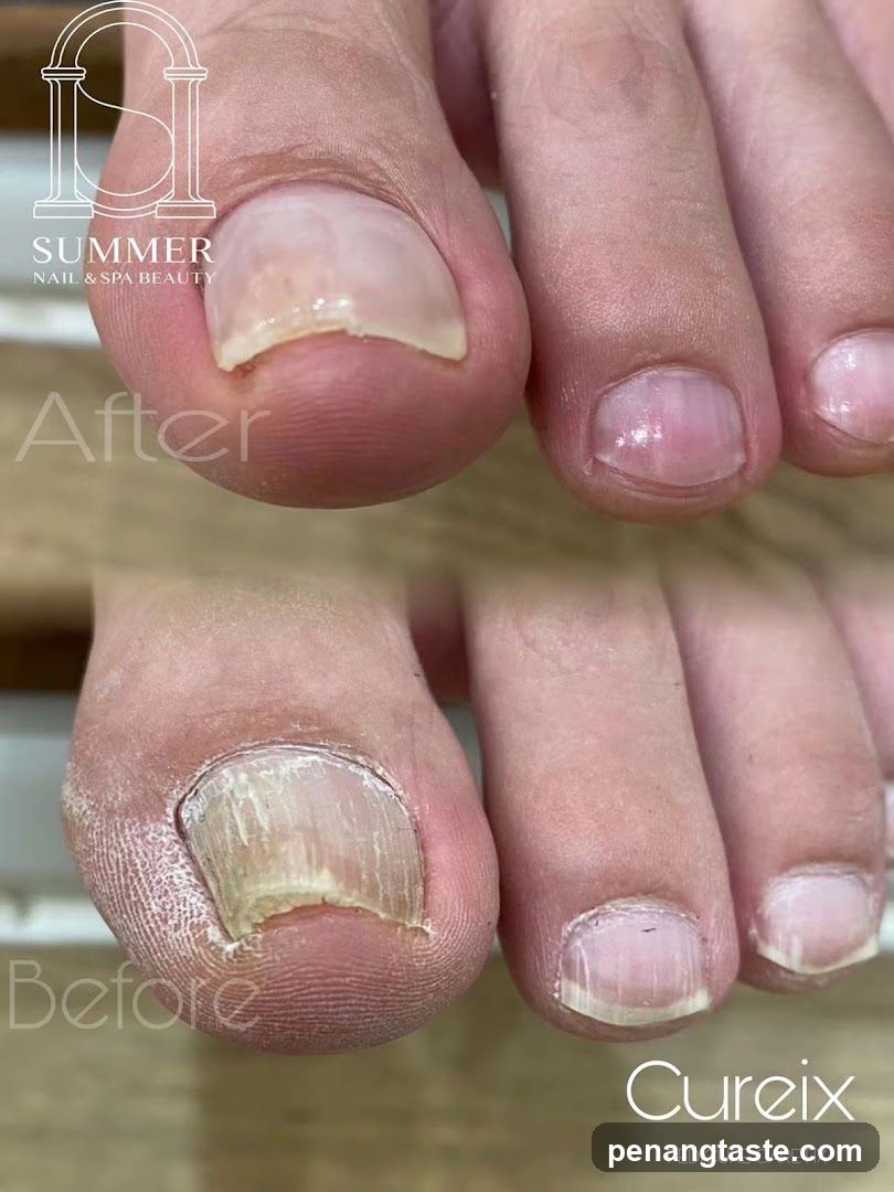 Pedicure Before and After