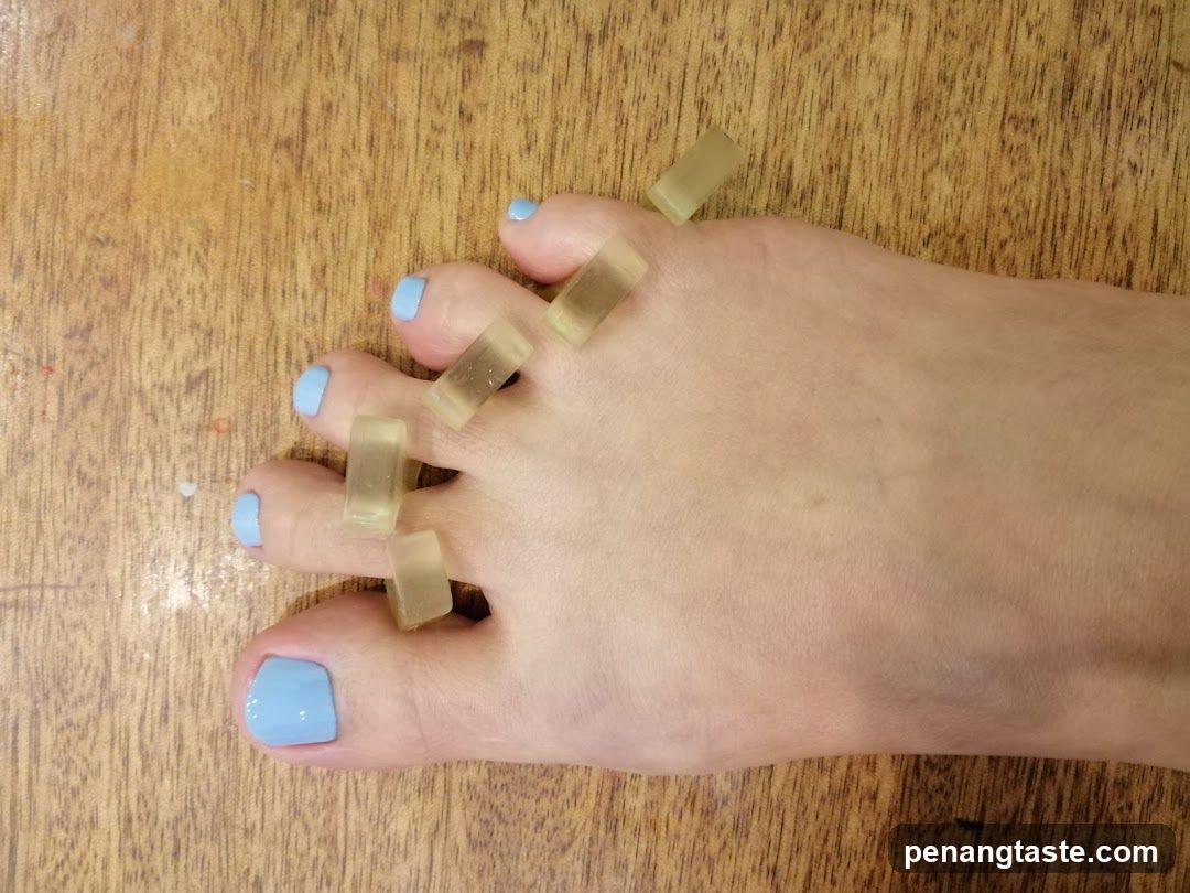 Foot with toe separators