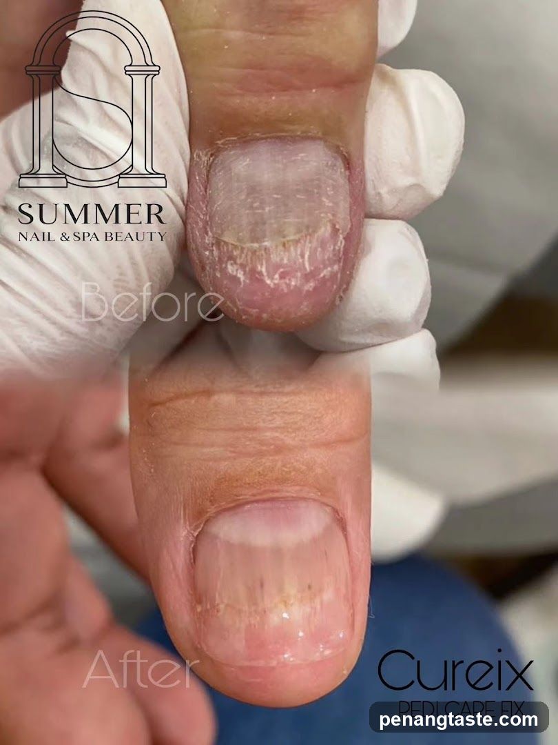 Before and After Pedicure Treatment