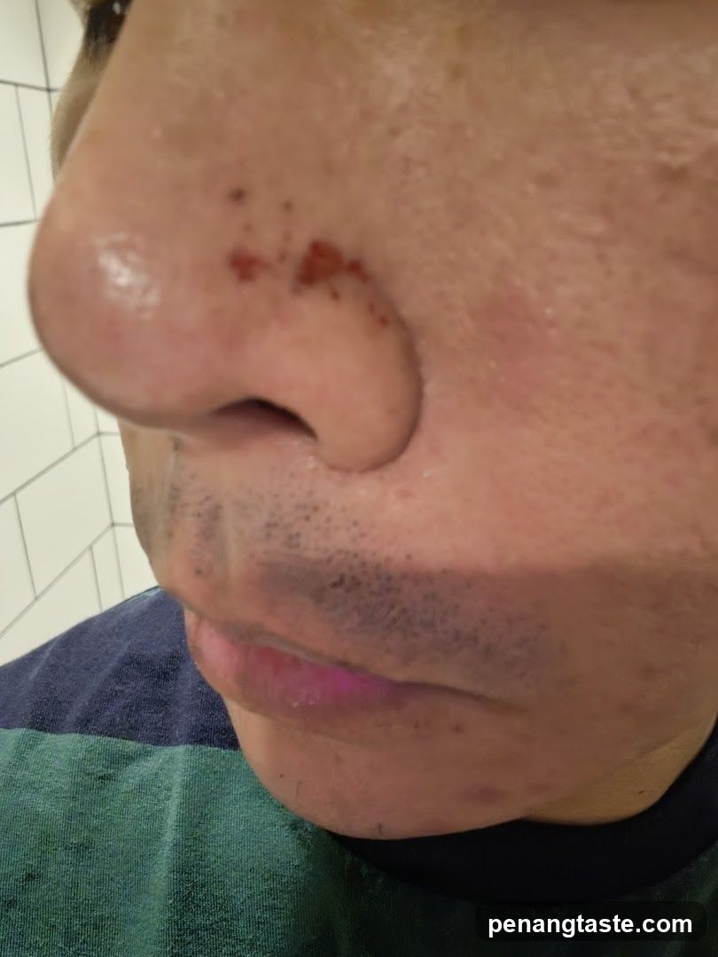Close-up of face with nosebleed