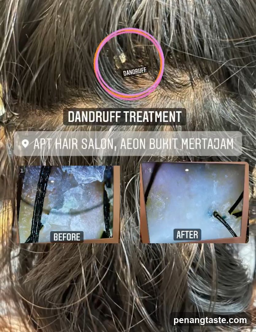Dandruff Treatment Ad