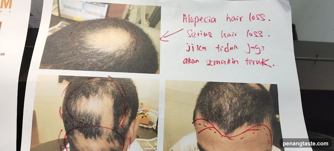 Hair Loss Condition Report
