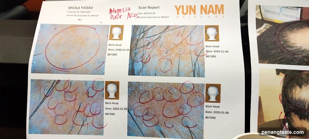 Hair Loss Scan Report